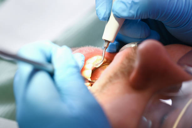 Best Emergency Treatment for Dental Infections or Abscesses in Waunakee, WI