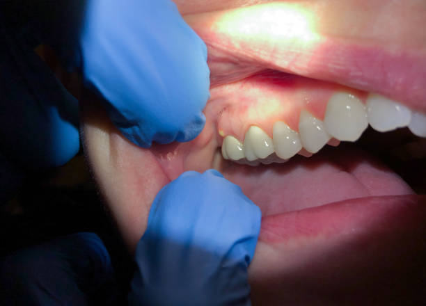 Best Emergency Gum Treatment in Waunakee, WI
